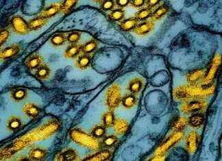 First Human Bird Flu Case Reported in Iowa: Health Department first-human-bird-flu-case-reported-in-owa-health-department