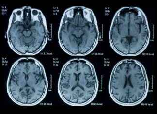 Signs of Trouble in Older Loved Ones During Holiday Visits – Radio Iowa signs-of-trouble-in-older-loved-ones-during-holiday-visits-radio-owa