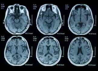 owans-changing-attitudes-towards-alzheimers-survey-results